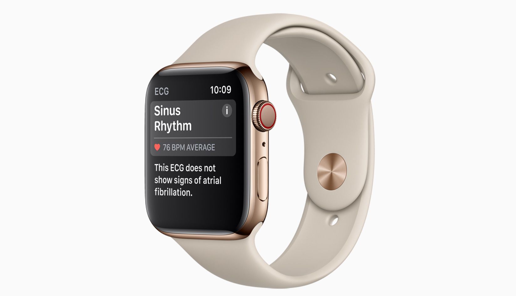 Apple Watch, показывающие результат Sinus Rhythm